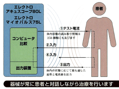 アキュスコープの治療メカニズム